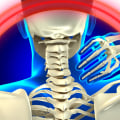 What Does Mild Whiplash Feel Like?