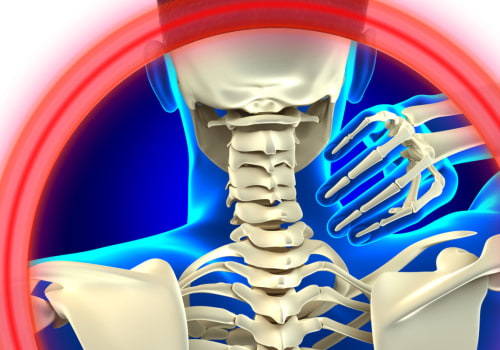 What Does Mild Whiplash Feel Like?